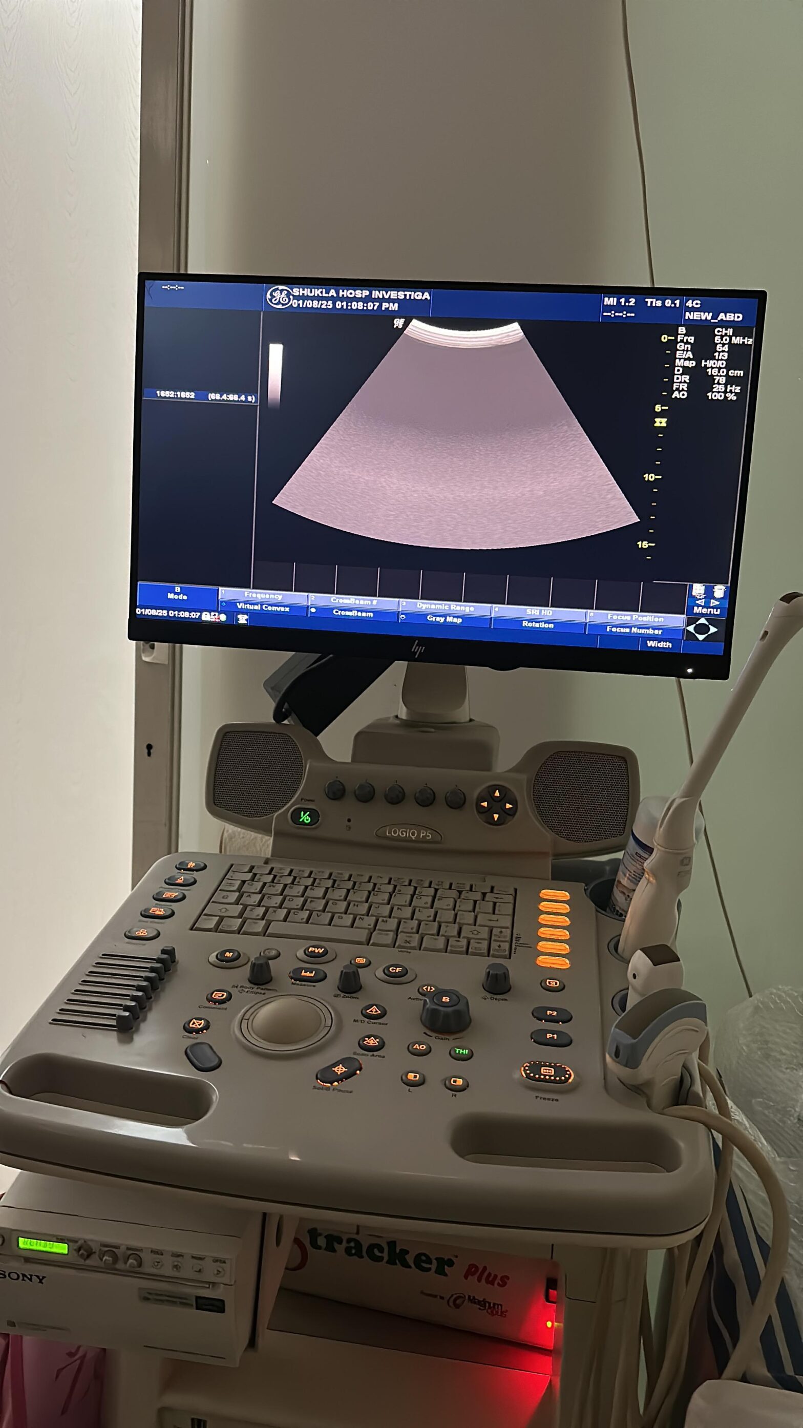 2K LED Screen Installation on Sonography Machine